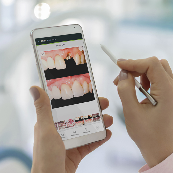 The Role of Before and After Photos in Dental Consultations
