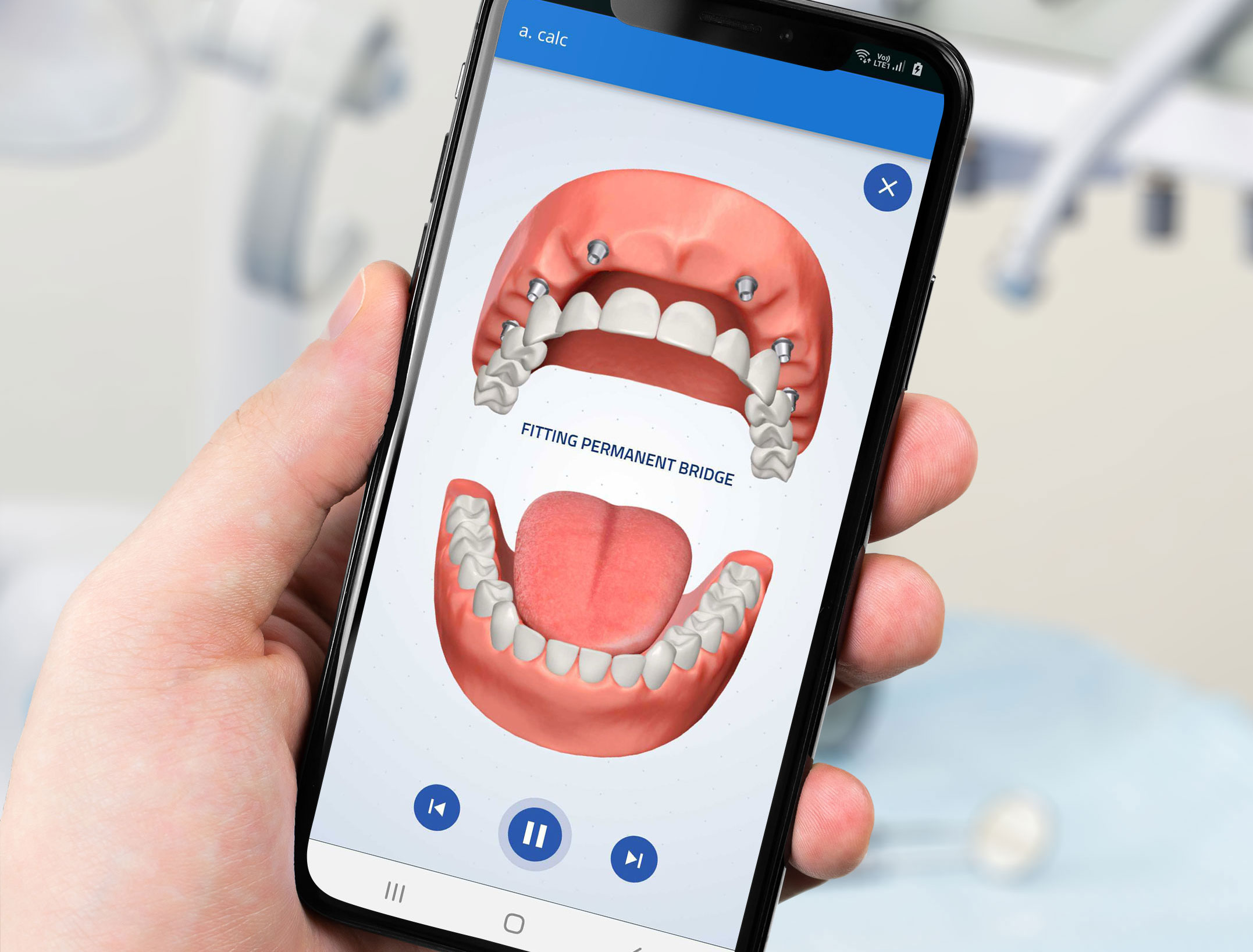 Dentist-patient communication
