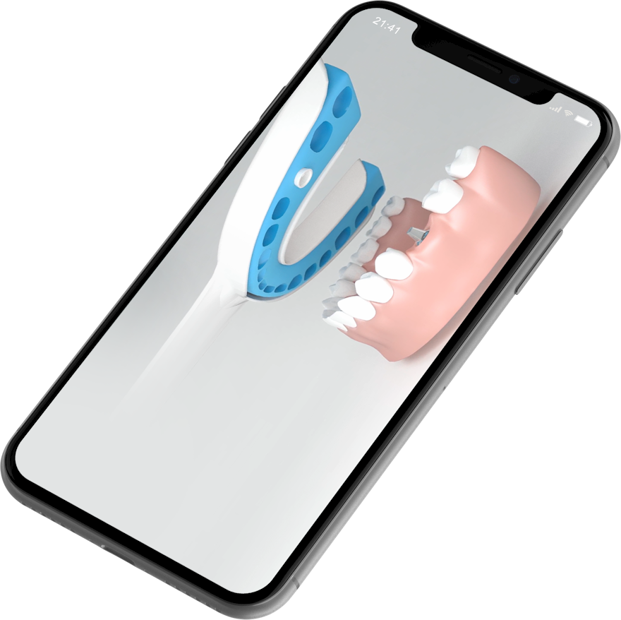 Dental treatment animations